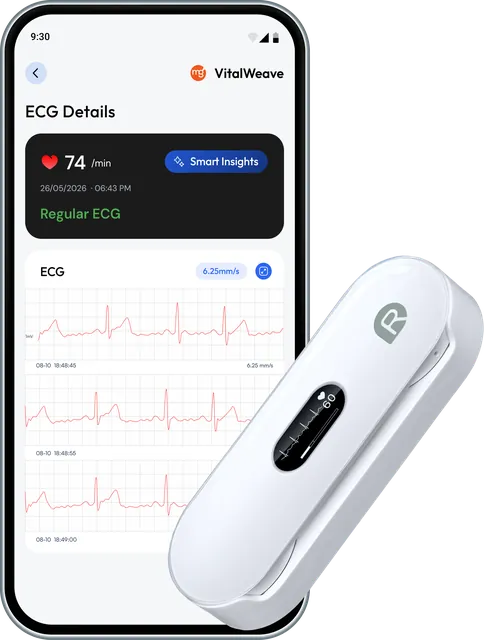 VitalWeave ECG device with the app's ECG view